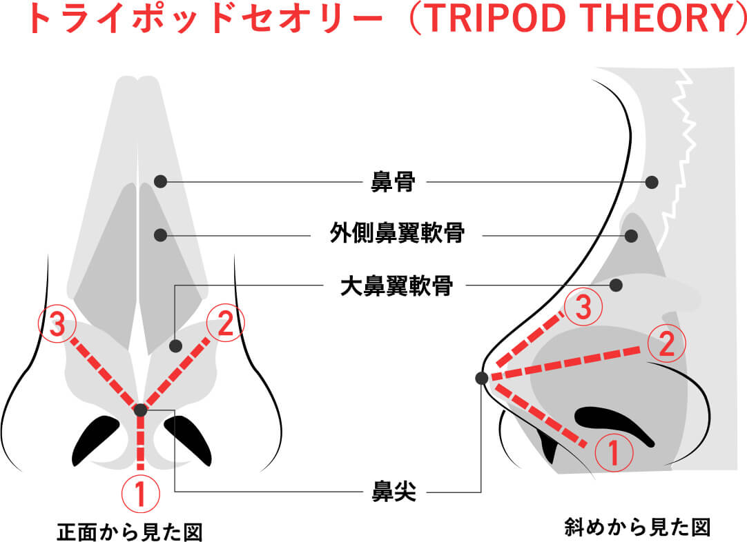 トライポッド理論の図