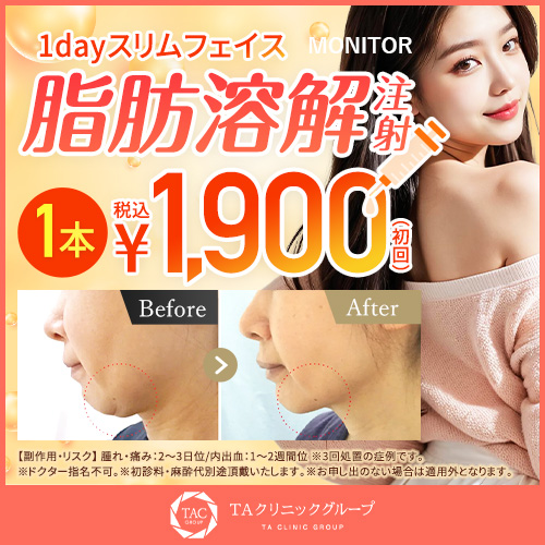 1dayスリムフェイス_56%OFF_モニター募集