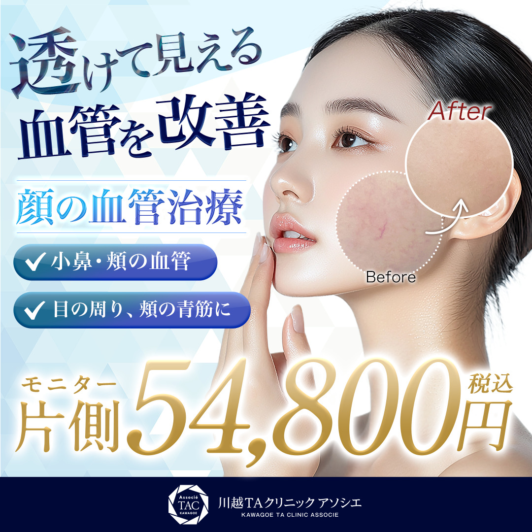 顔の血管治療_モニター募集